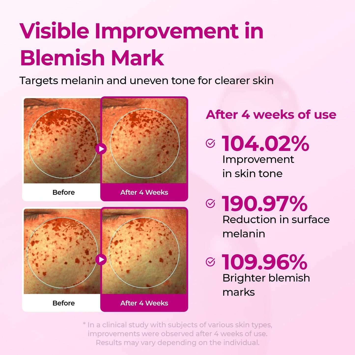 Set de 5 piezas para reafirmar y densificar la piel, lifting facial y de cuello – Edición Primavera