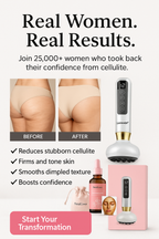 Lumisculpt™ – Anti-Cellulite Massager + 4 FREE gifts