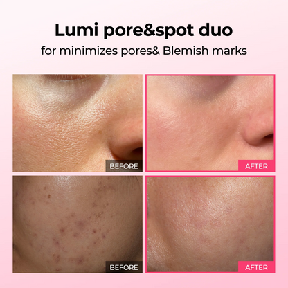 Lumi Pore & Spot Care Duo